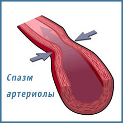 Артериальная гипертония лечение